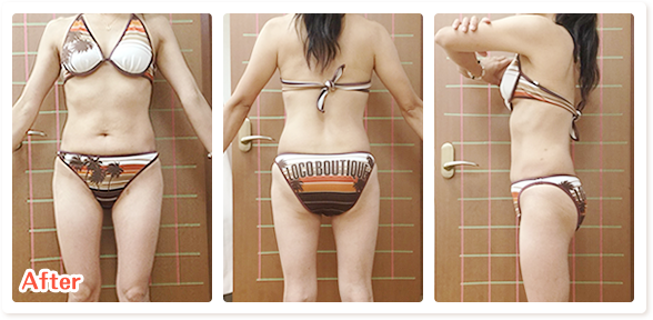 東洋療法整骨院ダイエットのアフター