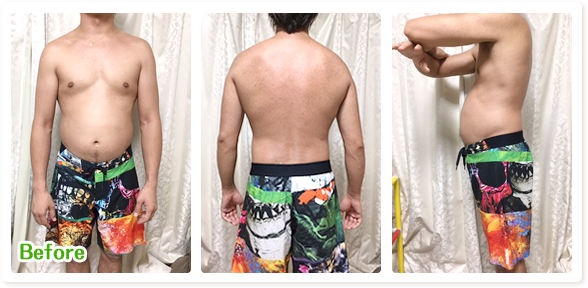 東洋療法整骨院ダイエットのビフォー